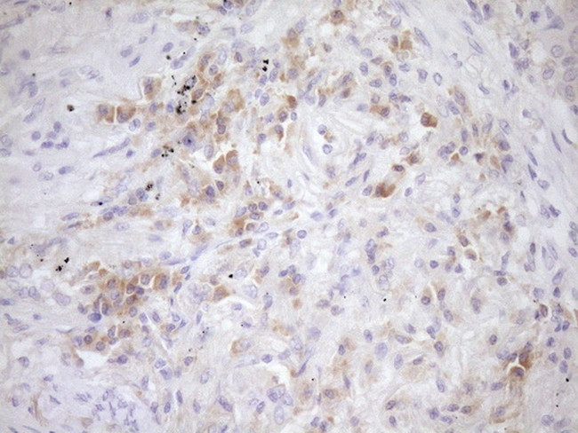 EIF3D Antibody in Immunohistochemistry (Paraffin) (IHC (P))