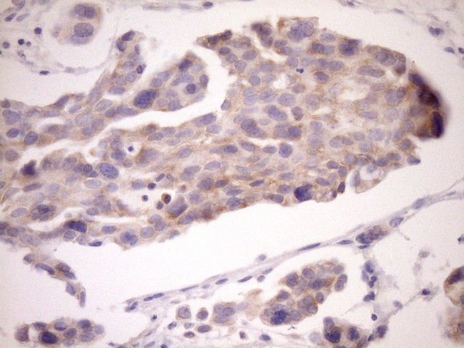 EIF3D Antibody in Immunohistochemistry (Paraffin) (IHC (P))