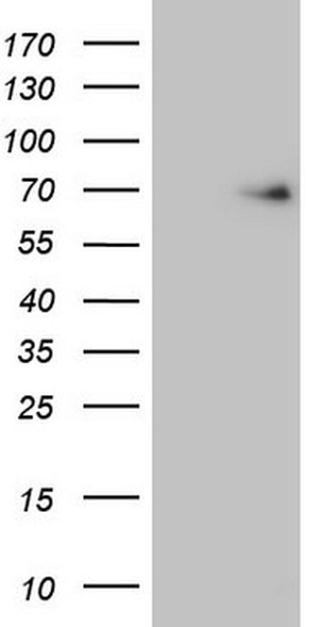 EIF3D Antibody in Western Blot (WB)