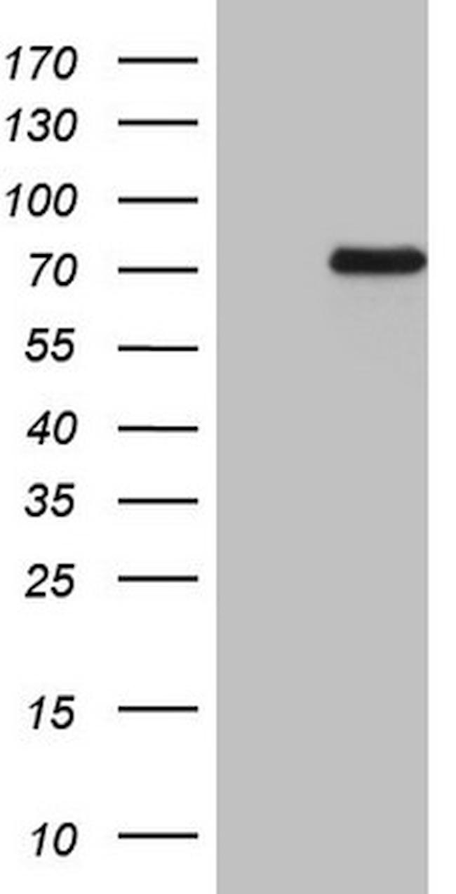 EIF3D Antibody in Western Blot (WB)