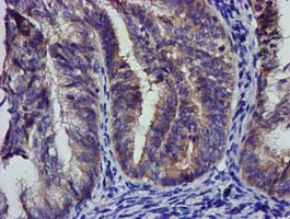 EIF4E Antibody in Immunohistochemistry (Paraffin) (IHC (P))