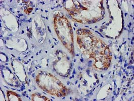 EIF4E Antibody in Immunohistochemistry (Paraffin) (IHC (P))