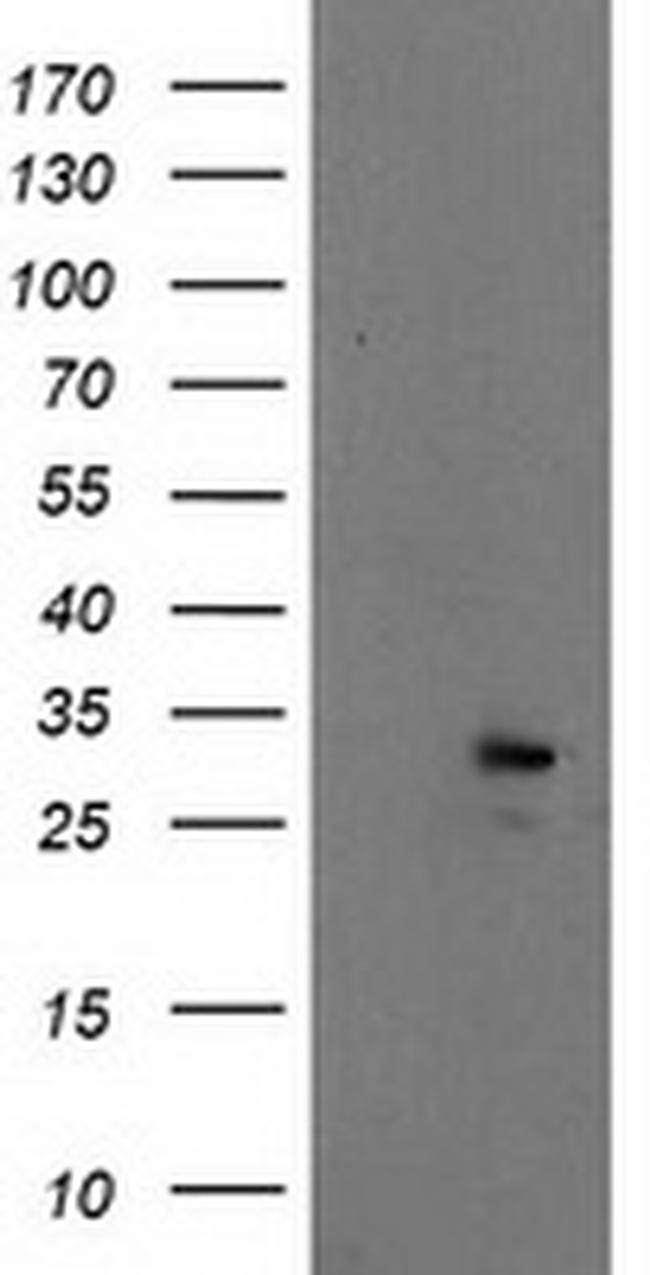 EIF4E Antibody in Western Blot (WB)