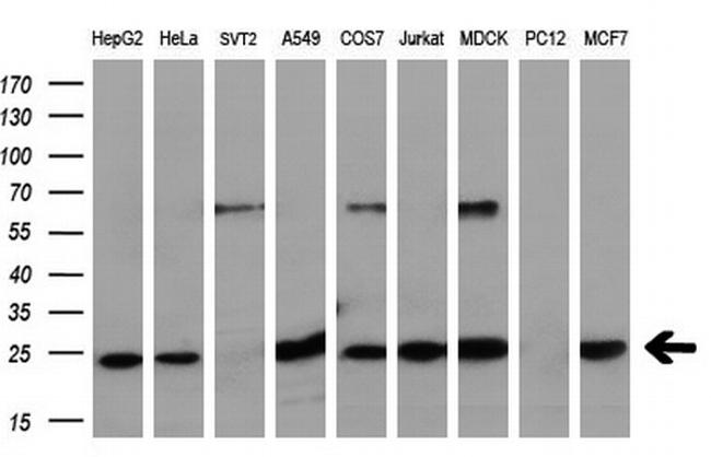 EIF4E Antibody in Western Blot (WB)