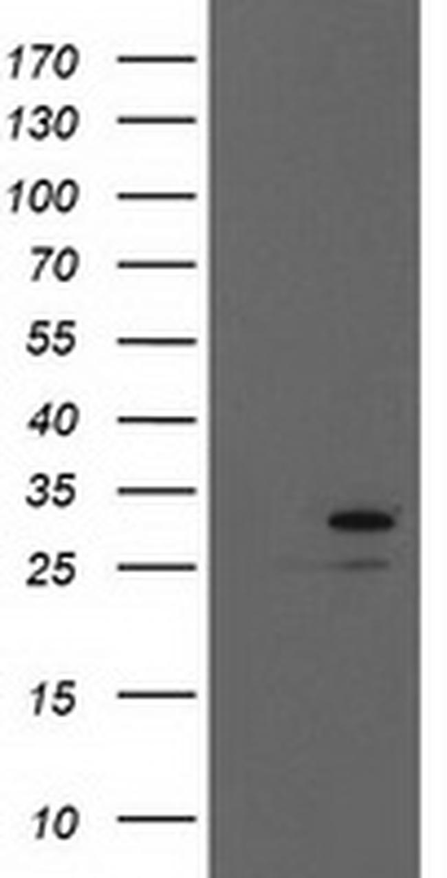 EIF4E Antibody in Western Blot (WB)