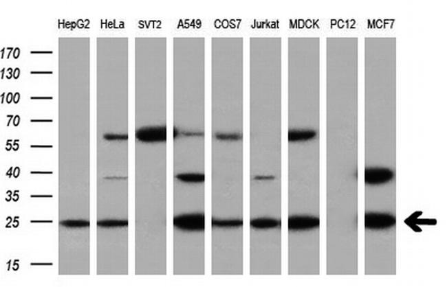 EIF4E Antibody in Western Blot (WB)