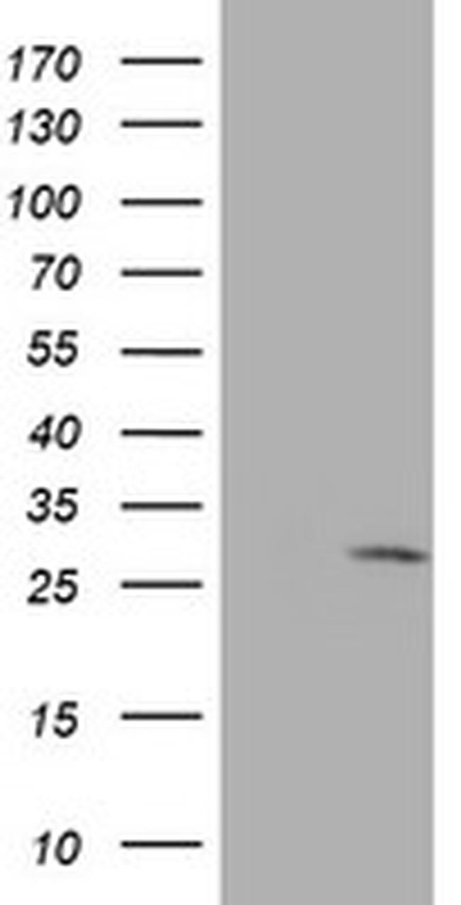 EIF4E Antibody in Western Blot (WB)