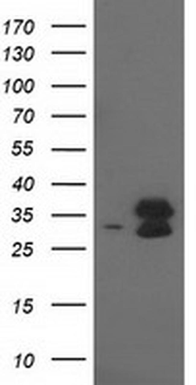 EIF4E2 Antibody in Western Blot (WB)