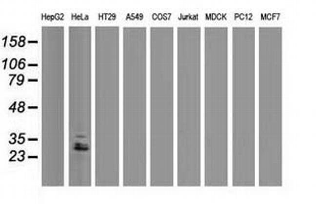 EIF4E2 Antibody in Western Blot (WB)