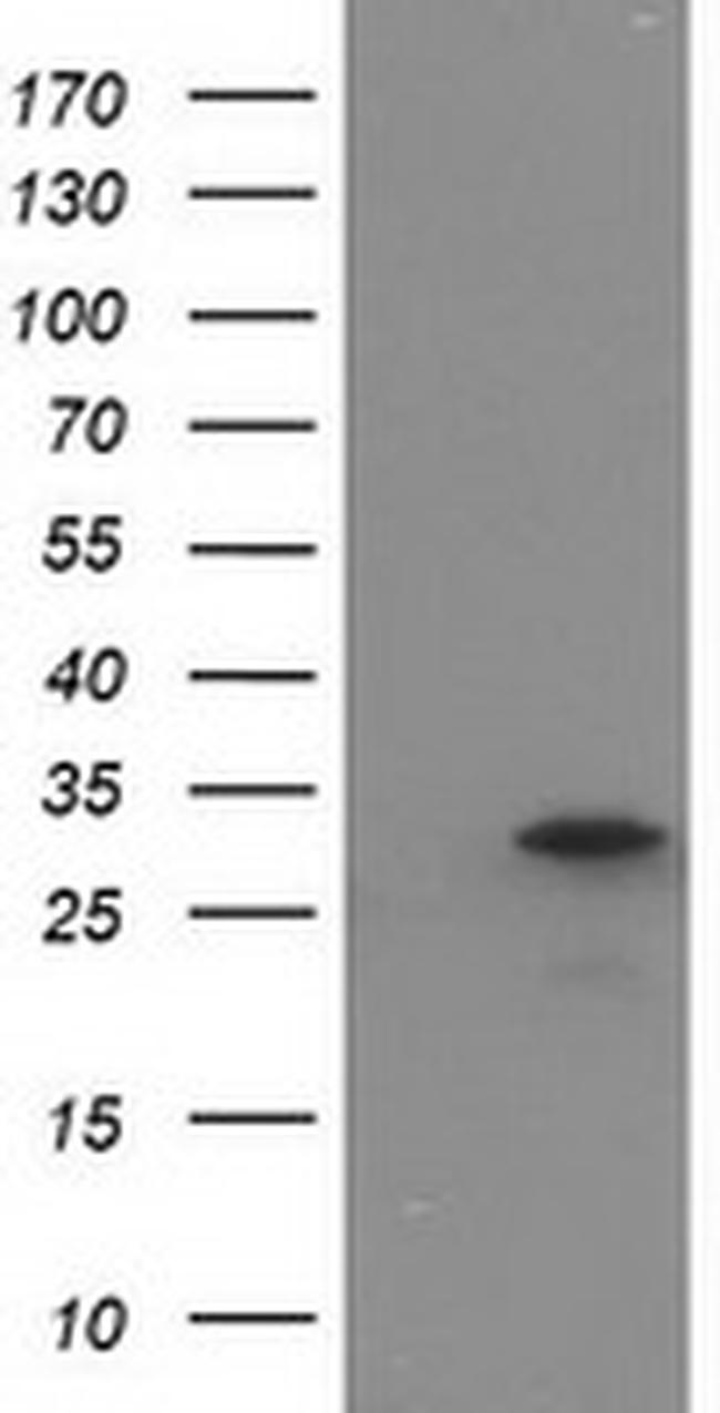 EIF4E2 Antibody in Western Blot (WB)