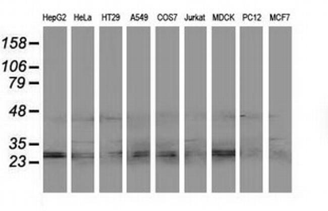 EIF4E2 Antibody in Western Blot (WB)