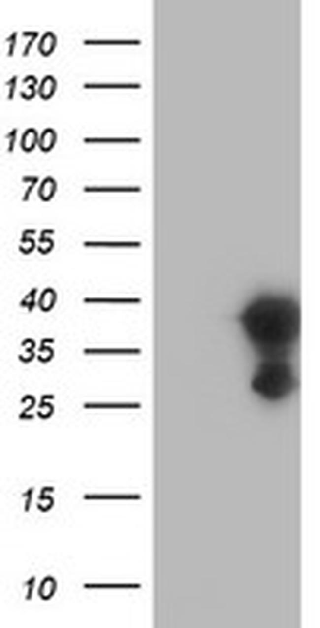 EIF4E2 Antibody in Western Blot (WB)