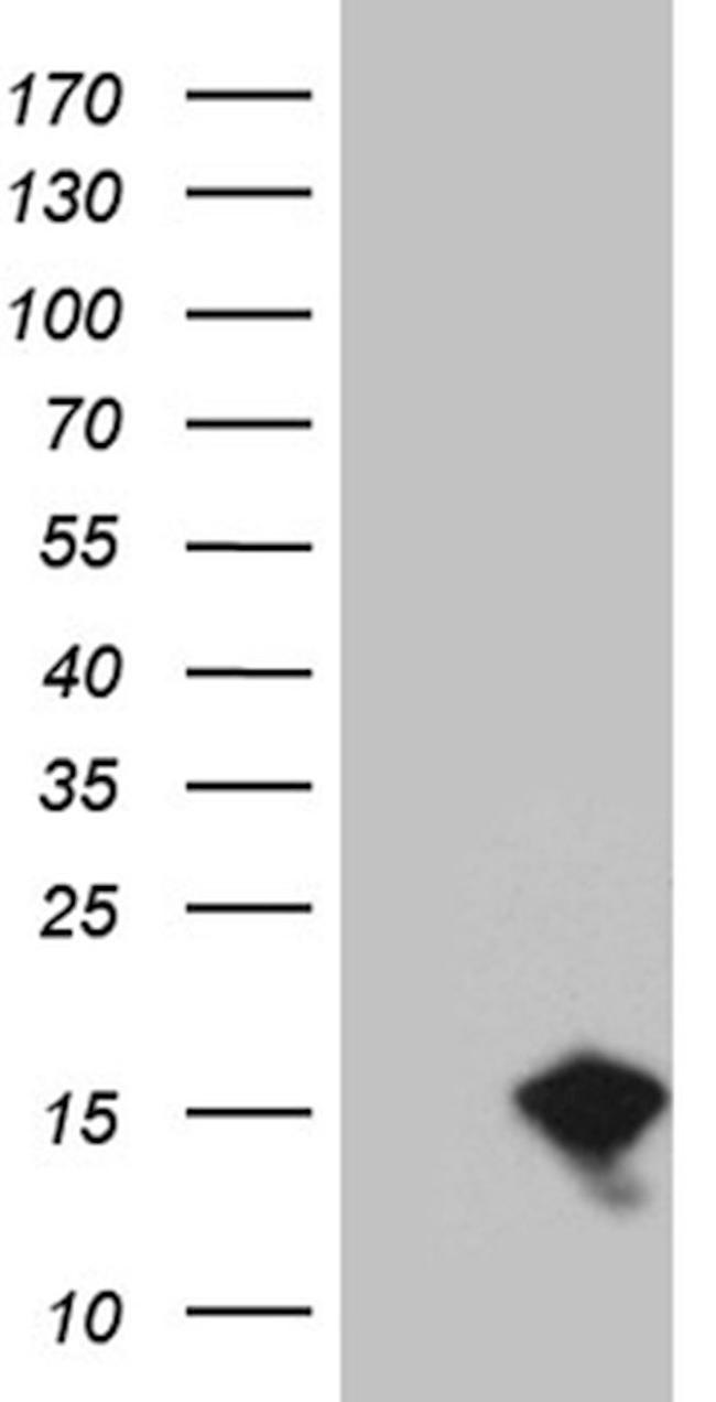 EIF4EBP3 Antibody in Western Blot (WB)