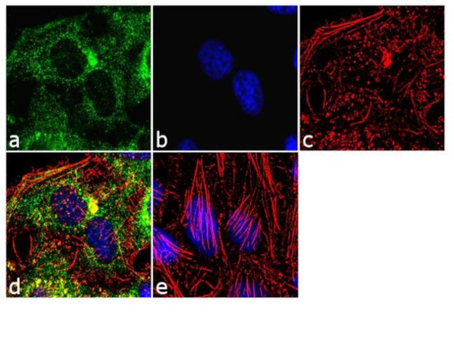 eIF5A Antibody in Immunocytochemistry (ICC/IF)