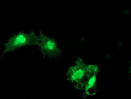 EIF5A2 Antibody in Immunocytochemistry (ICC/IF)