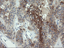 EIF5A2 Antibody in Immunohistochemistry (Paraffin) (IHC (P))