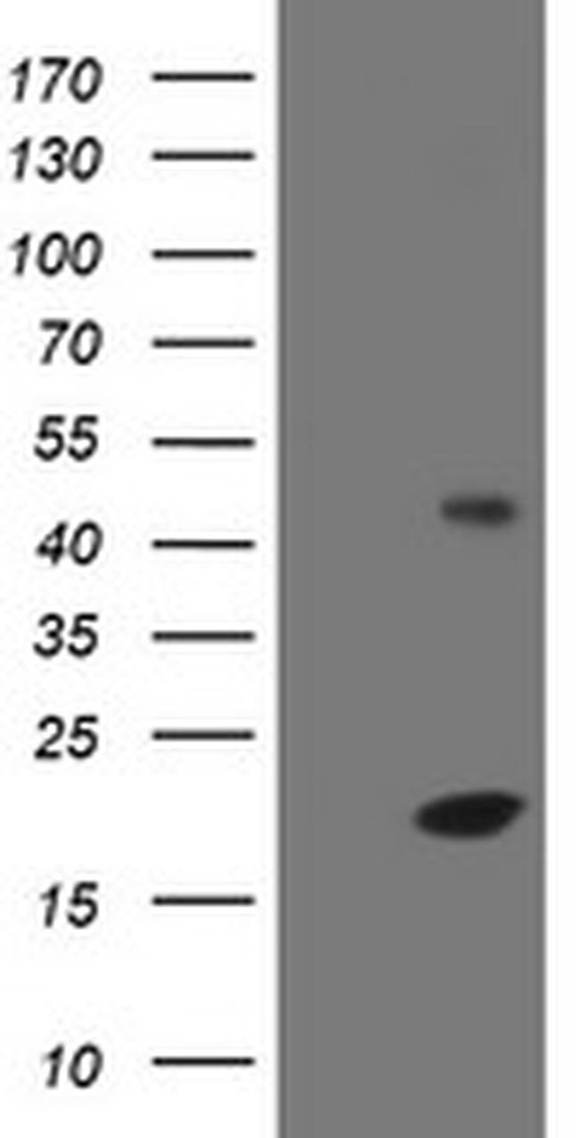 EIF5A2 Antibody in Western Blot (WB)