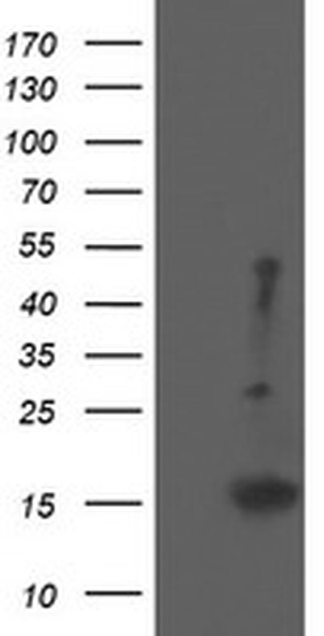 EIF5A2 Antibody in Western Blot (WB)