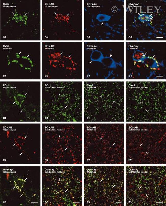 ZONAB Antibody in Immunohistochemistry (IHC)