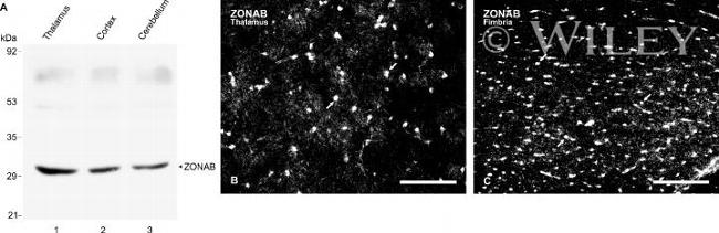 ZONAB Antibody in Western Blot, Immunocytochemistry (WB, ICC/IF)