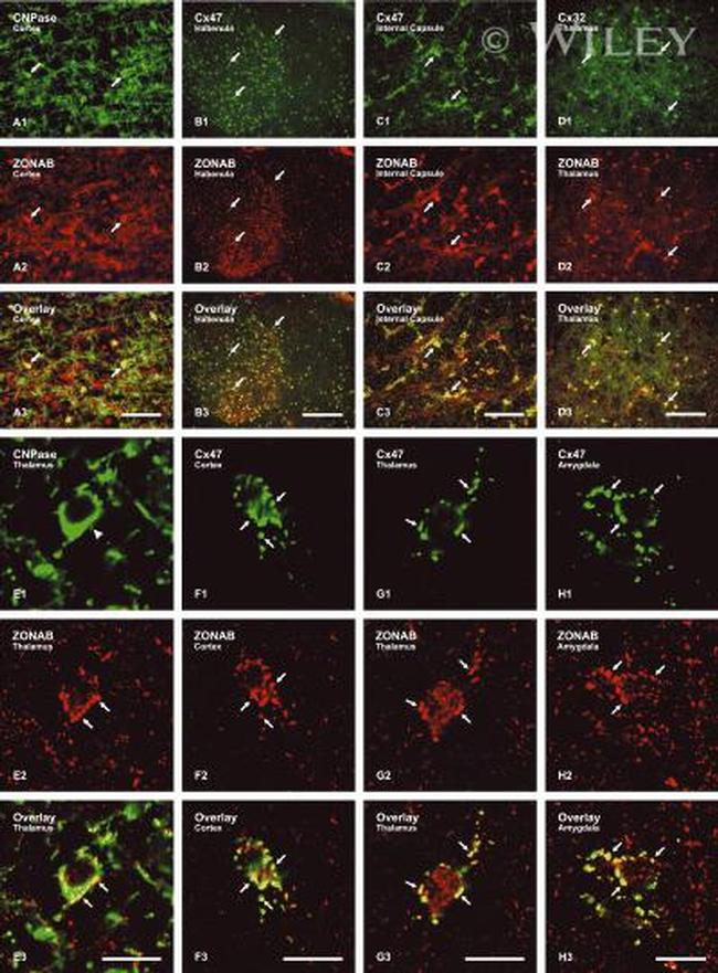 ZONAB Antibody in Immunohistochemistry (IHC)