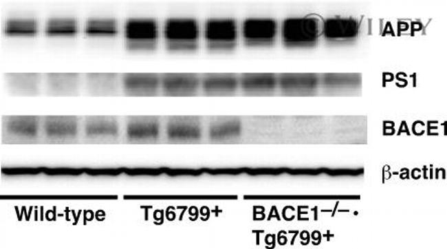 BACE1 Antibody in Western Blot (WB)