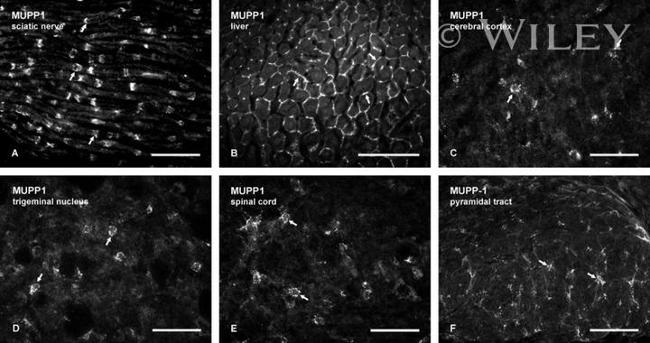 MUPP1 Antibody in Immunohistochemistry (IHC)