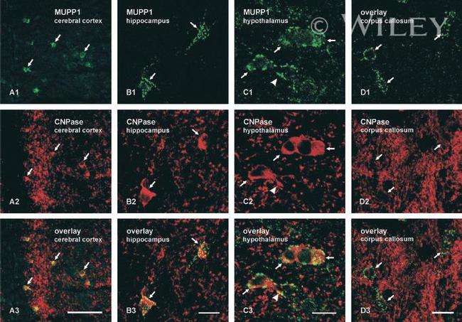 MUPP1 Antibody in Immunohistochemistry (IHC)