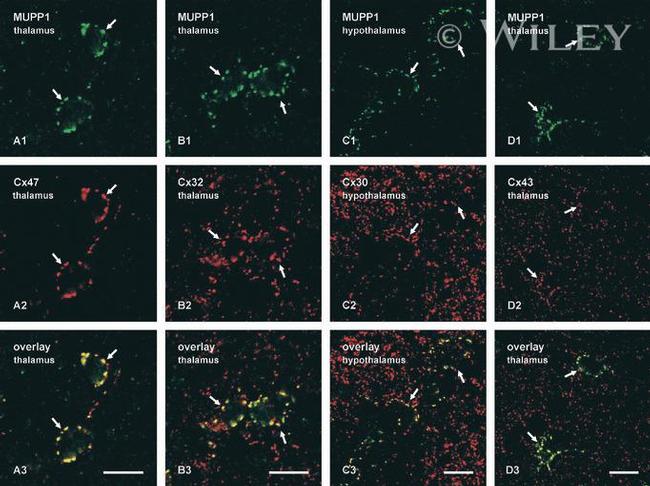 MUPP1 Antibody in Immunohistochemistry (IHC)