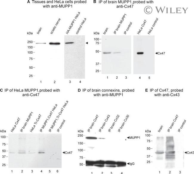 MUPP1 Antibody in Western Blot (WB)