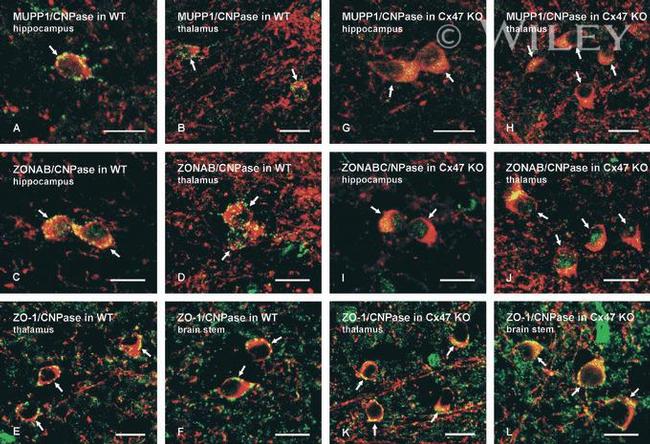 MUPP1 Antibody in Immunohistochemistry (IHC)