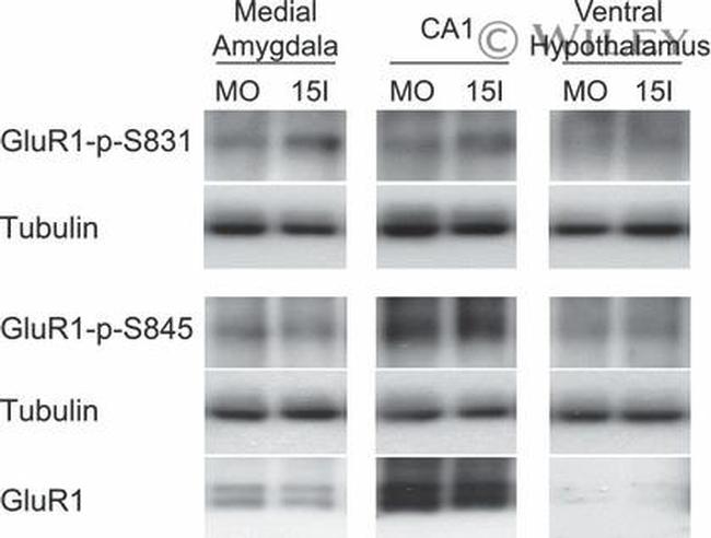 Phospho-GluR1 (Ser831) Antibody in Western Blot (WB)