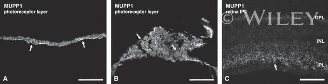 MUPP1 Antibody in Immunohistochemistry (IHC)