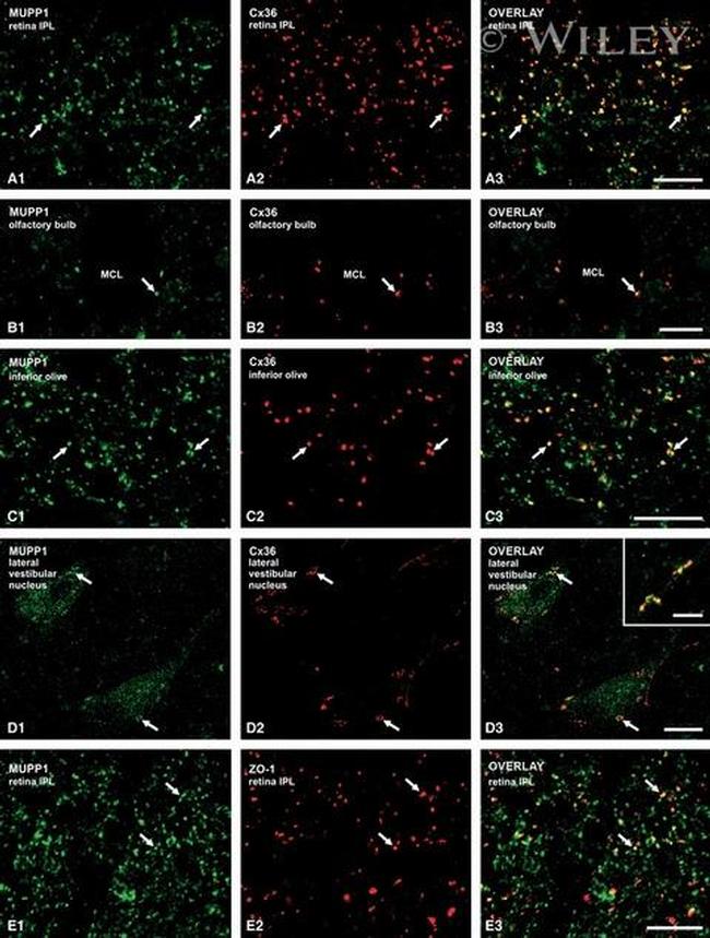 MUPP1 Antibody in Immunohistochemistry (IHC)