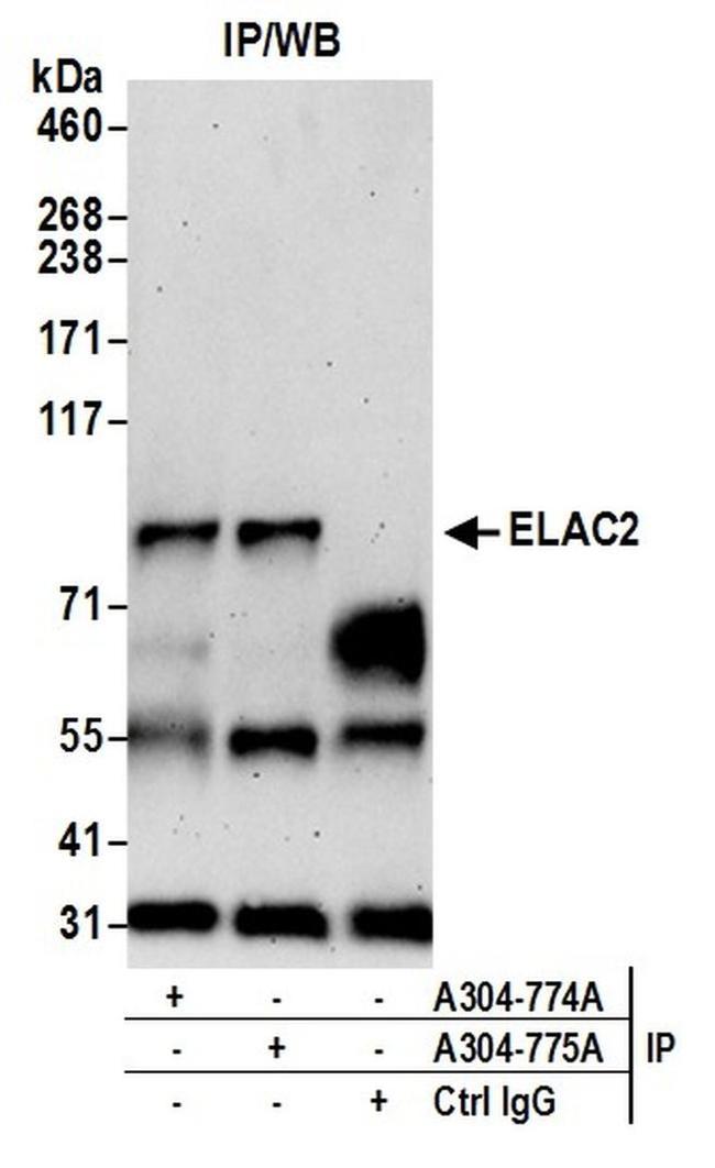 ELAC2 Antibody in Western Blot (WB)