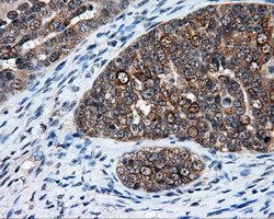 ELAVL1 Antibody in Immunohistochemistry (Paraffin) (IHC (P))