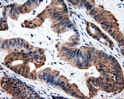 ELAVL1 Antibody in Immunohistochemistry (Paraffin) (IHC (P))