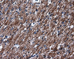 ELAVL1 Antibody in Immunohistochemistry (Paraffin) (IHC (P))