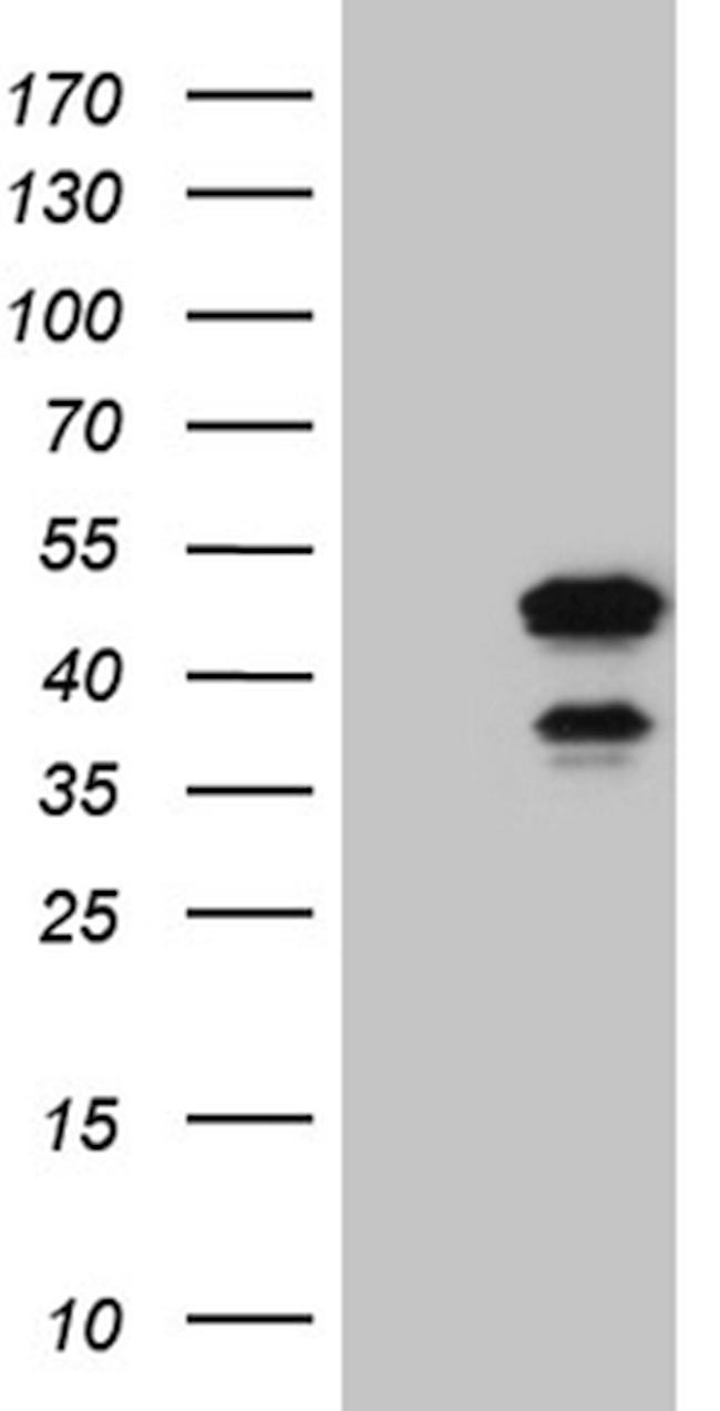 ELF3 Antibody in Western Blot (WB)