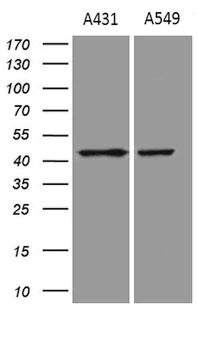 ELF3 Antibody in Western Blot (WB)