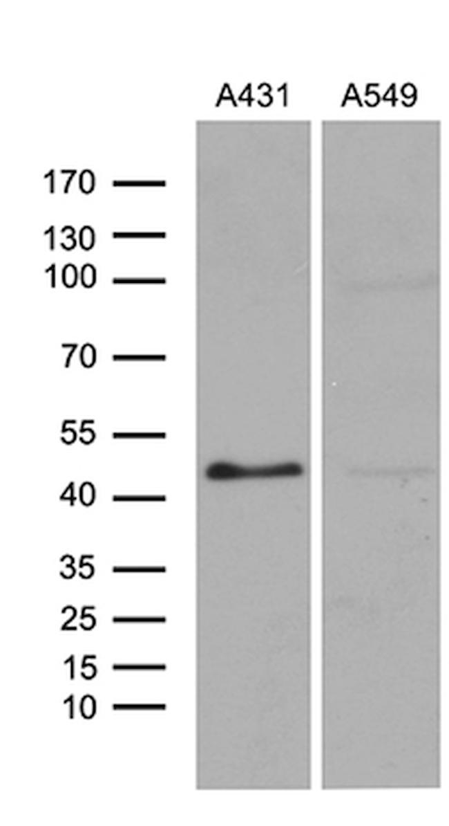 ELF3 Antibody in Western Blot (WB)