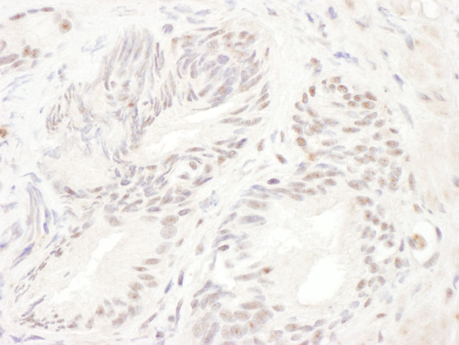 ELK1 Antibody in Immunohistochemistry (IHC)