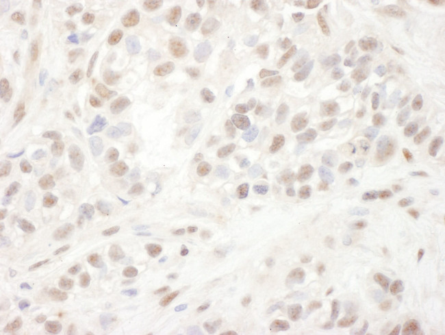 ELK1 Antibody in Immunohistochemistry (IHC)