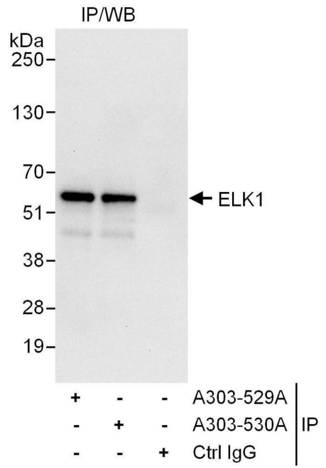 ELK1 Antibody in Immunoprecipitation (IP)