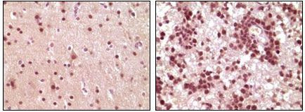 ELK1 Antibody in Immunohistochemistry (Paraffin) (IHC (P))