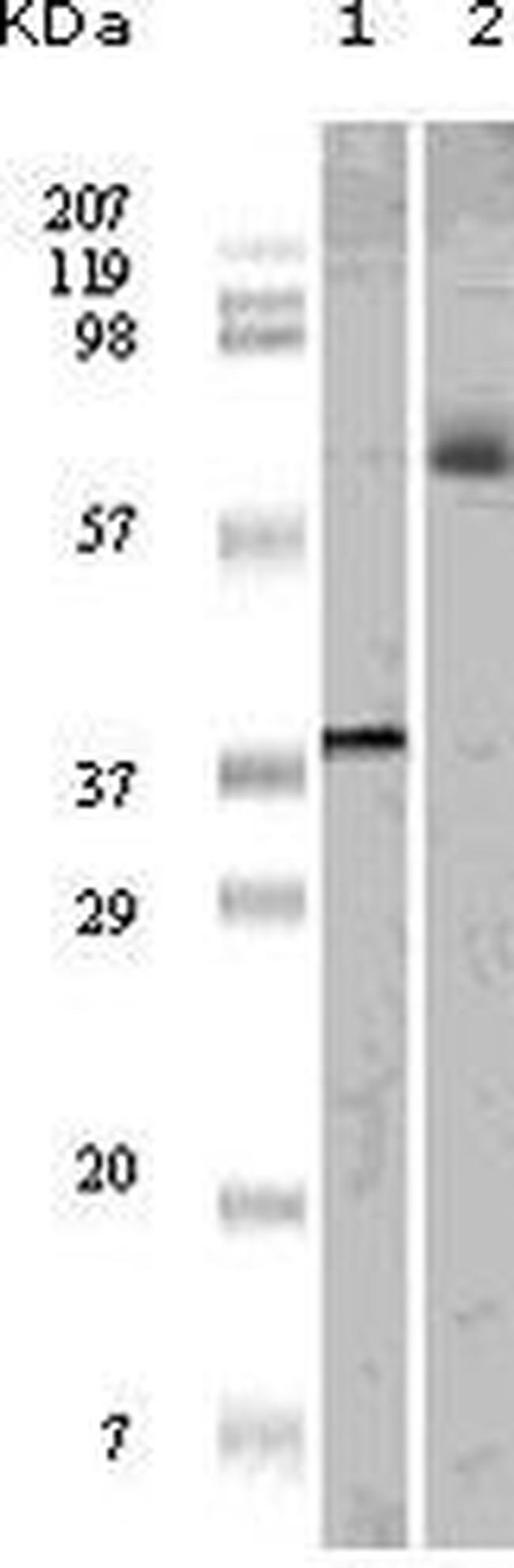 ELK1 Antibody in Western Blot (WB)