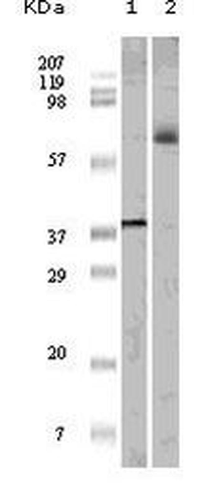 ELK1 Antibody in Western Blot (WB)