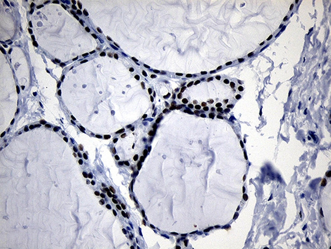 ELL Antibody in Immunohistochemistry (Paraffin) (IHC (P))