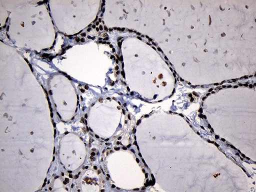 ELL Antibody in Immunohistochemistry (Paraffin) (IHC (P))