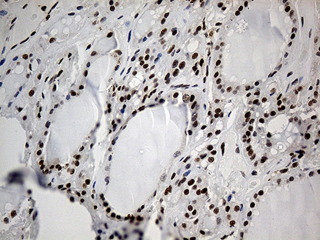 ELL Antibody in Immunohistochemistry (Paraffin) (IHC (P))